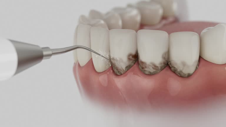Trusted Dental Implants service in Decherd, TN - Dentist Open Now